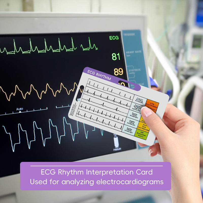 Spiekbriefje voor ECG-interpre - Photography Cheat Sheet recensie en prijs